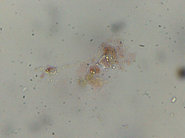 Haematococcus pluvialis e philodina